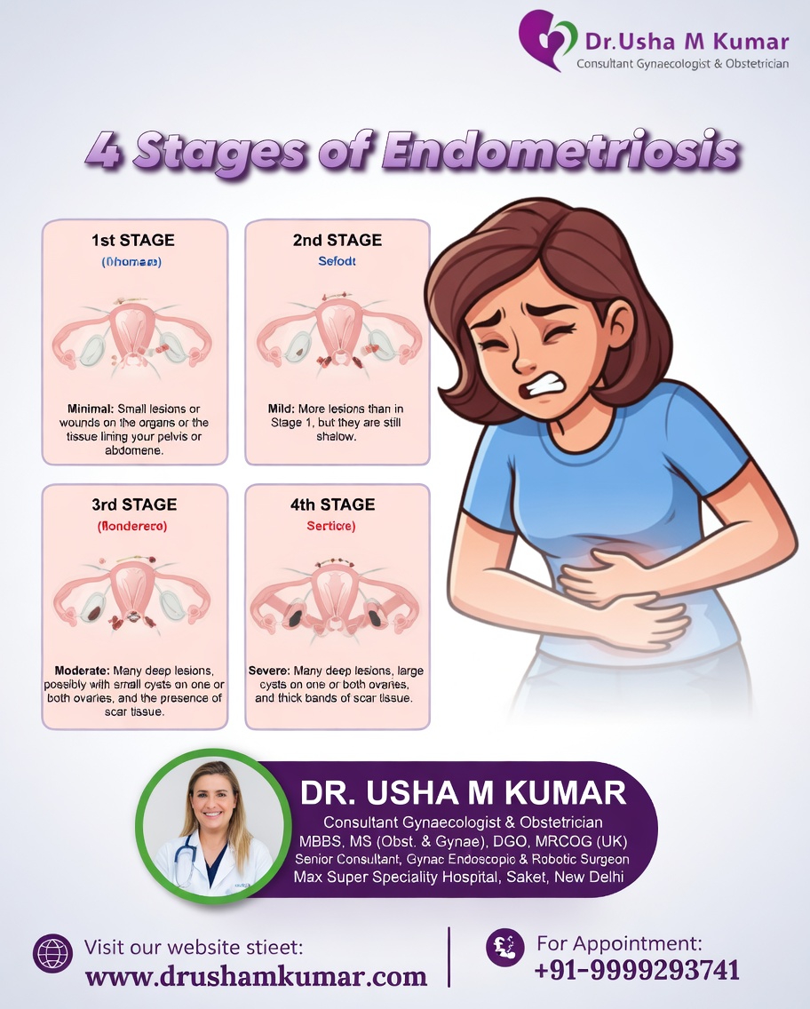 What Every Woman Should Know About Endometriosis