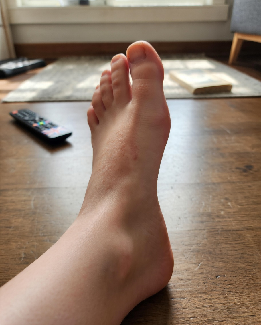 Understanding the Common Side Effects of Amlodipine That Patients Frequently Encounter and Simple Ways to Manage Them