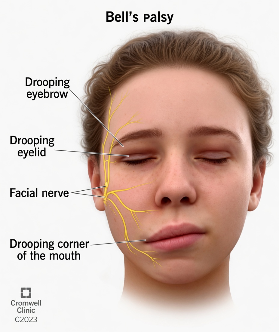 What Facial Changes During Sleep Might Signal About Brain Health Risks