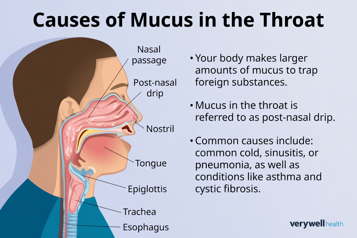 Why You Have Persistent Phlegm in Your Throat and Everyday Factors You Should Know About