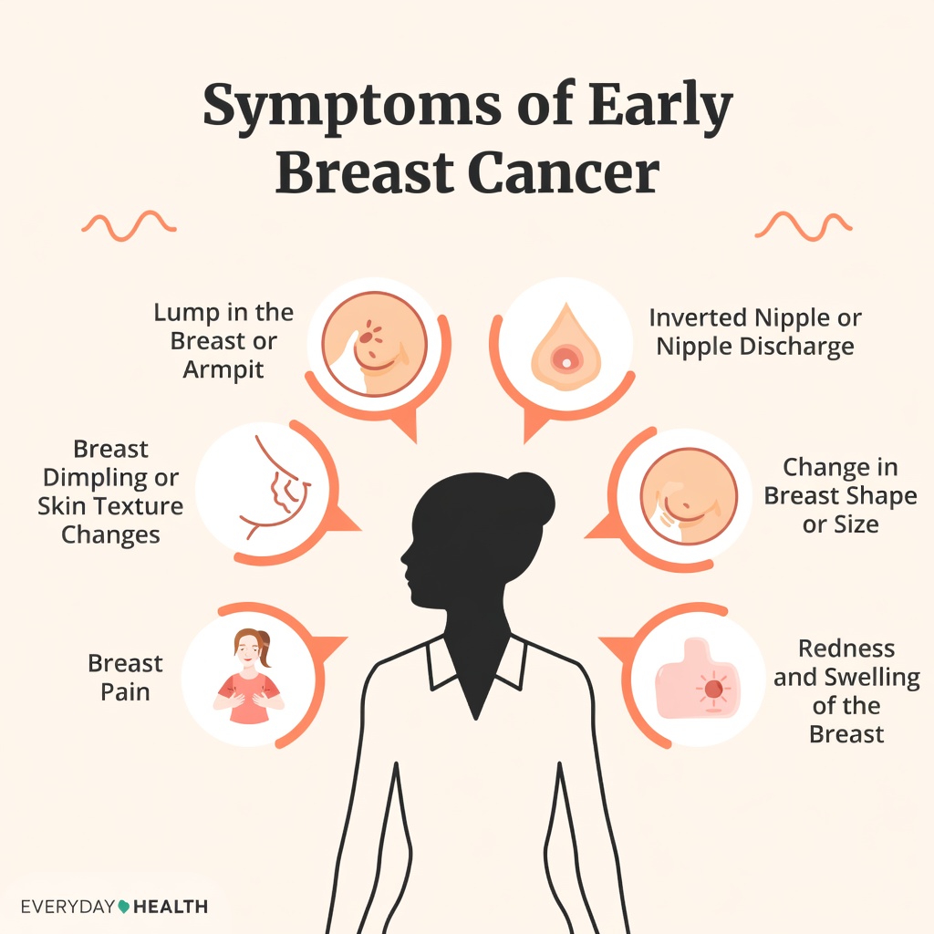 Are You Missing These Early Warning Signs of Breast Cancer? What Every Woman Should Know