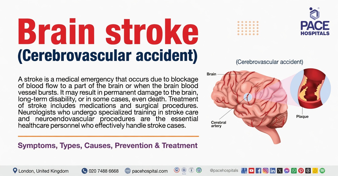 Could This Sleeping Symptom Be a Warning Sign of a Stroke?
