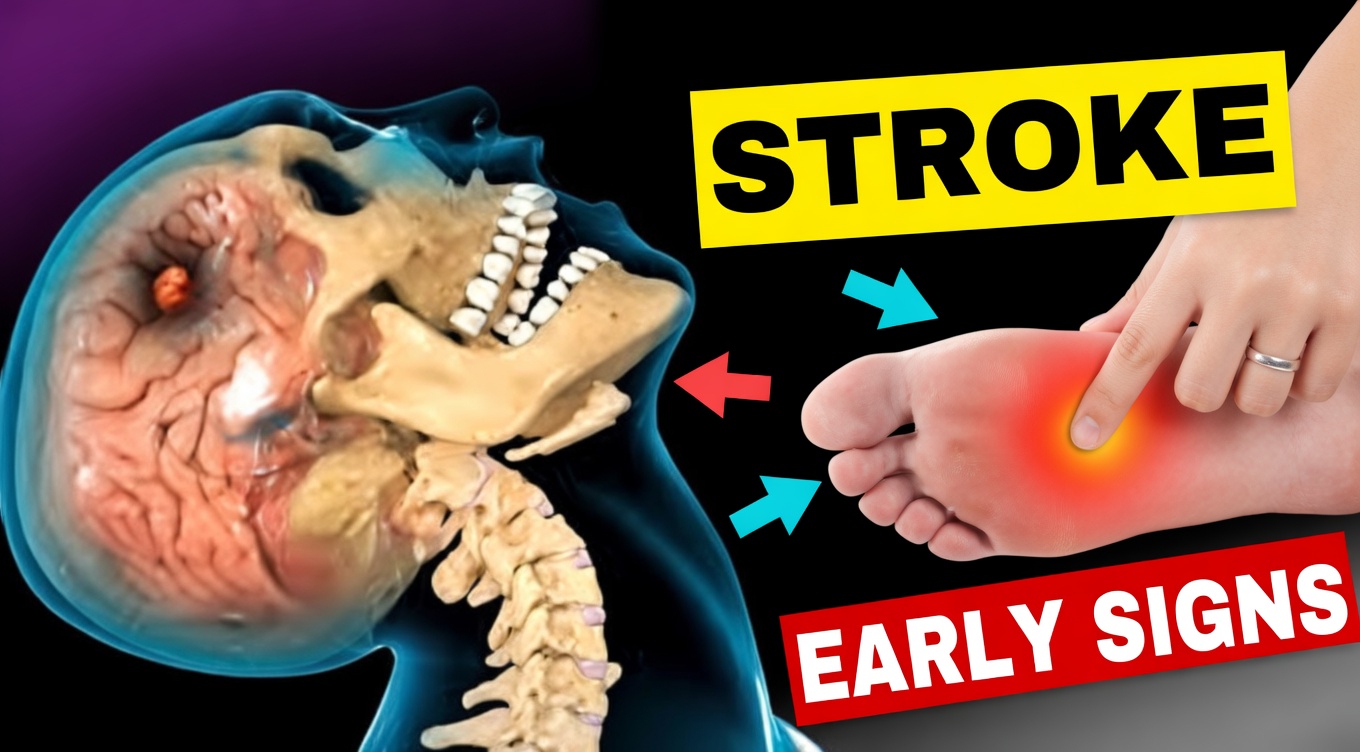 8 Subtle Warning Signs That Could Signal a Stroke Risk One Month in Advance + 9 Practical Tips to Lower Your Chances