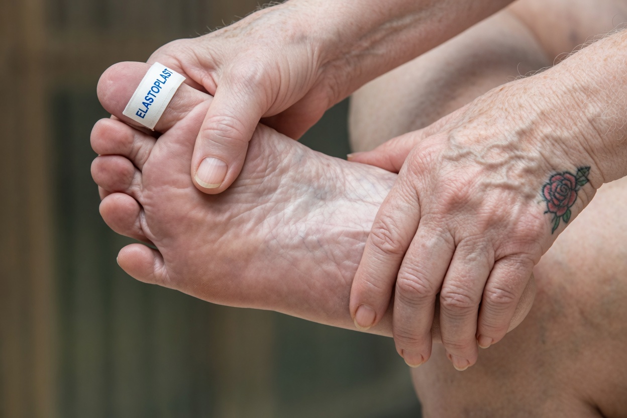 Could “Harmless” Leg Pain Be a Warning Sign You Shouldn’t Ignore?