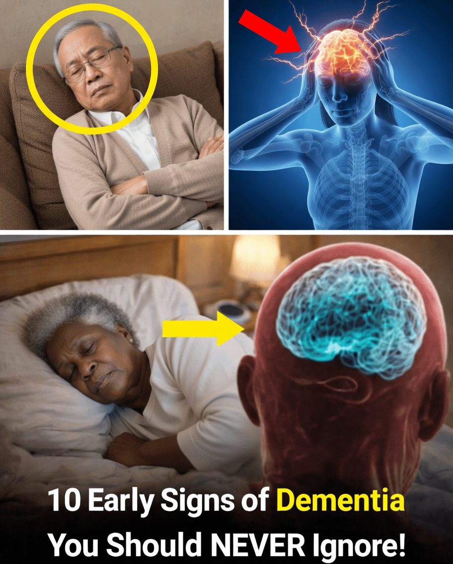 10 Early Signs of Dementia You Should Never Ignore