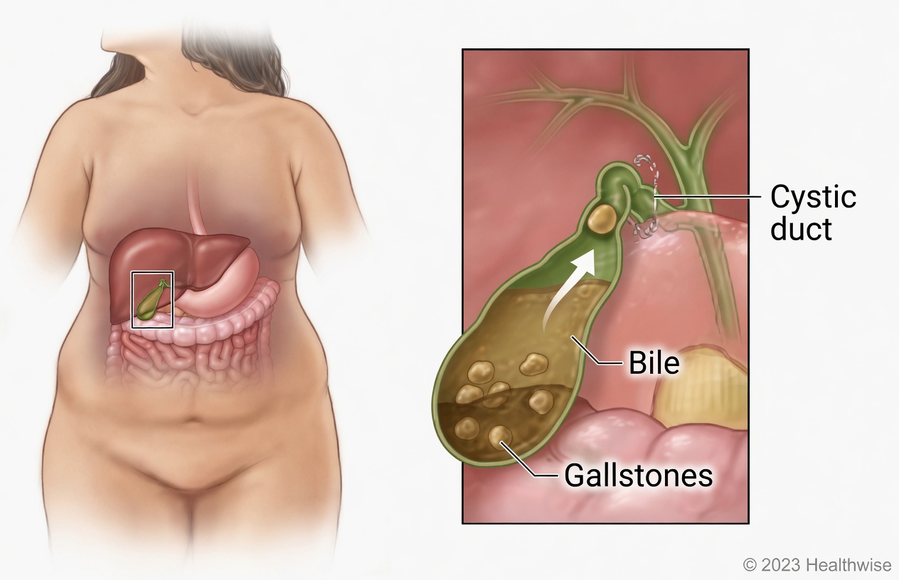 Discover Two Everyday Habits That May Support Gallbladder Comfort
