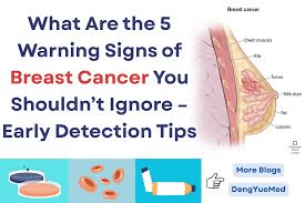 10 Warning Signs of Breast Cancer in Women You Should Never Ignore and Always Check with a Doctor