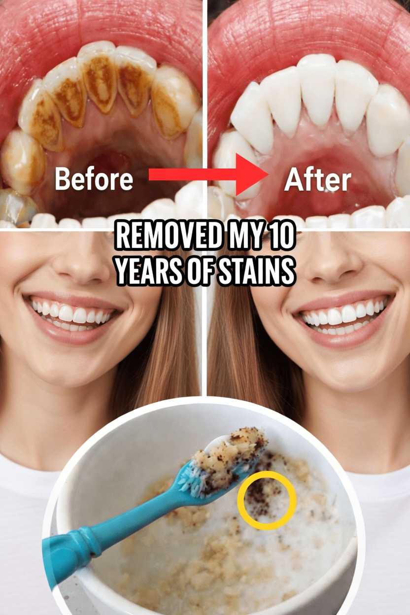 Why Surface Stains Happen and Why Gentle Polishing Matters