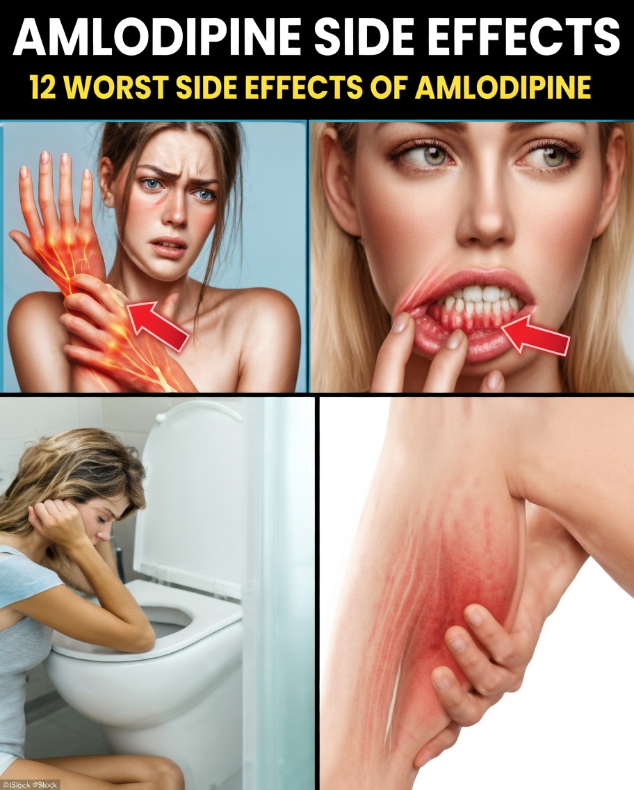 What Is Amlodipine and Why Does It Cause Side Effects?