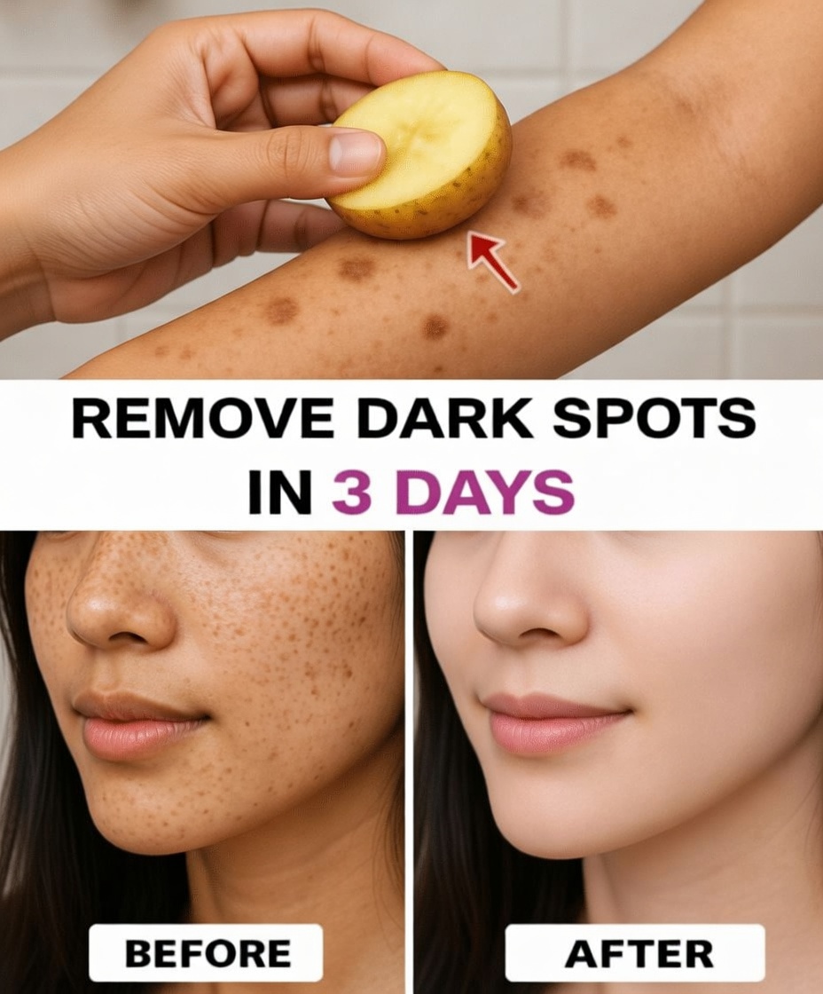 Eliminate age spots, melasma, sun spots, blemishes, and signs of aging.