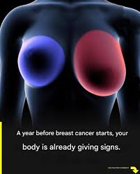 4 Early Warning Signs of Breast Cancer Every Woman Should Know About