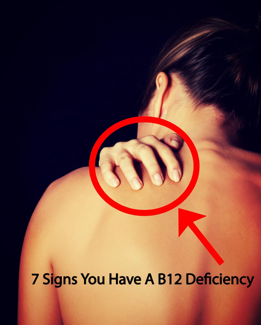 7 Clear Signs You Might Have a Vitamin B12 Deficiency