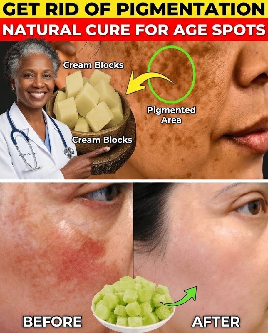 Erase Pigmentation, Melasma & Dark Spots Naturally in 20 Days – A Gentle Ritual for Radiant Skin