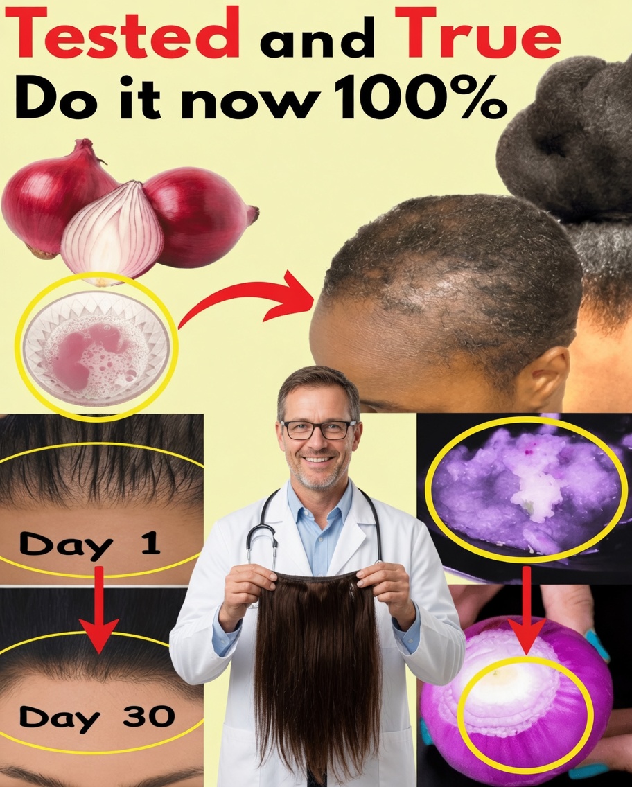Onion Oil for Hair Growth: A Simple Natural Remedy That Truly Works