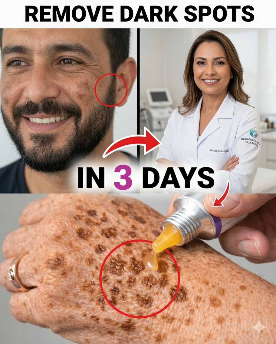 Remove Age Spots Naturally: Simple Cornstarch, Baking Soda, and Lemon Mask for Brighter, More Even Skin