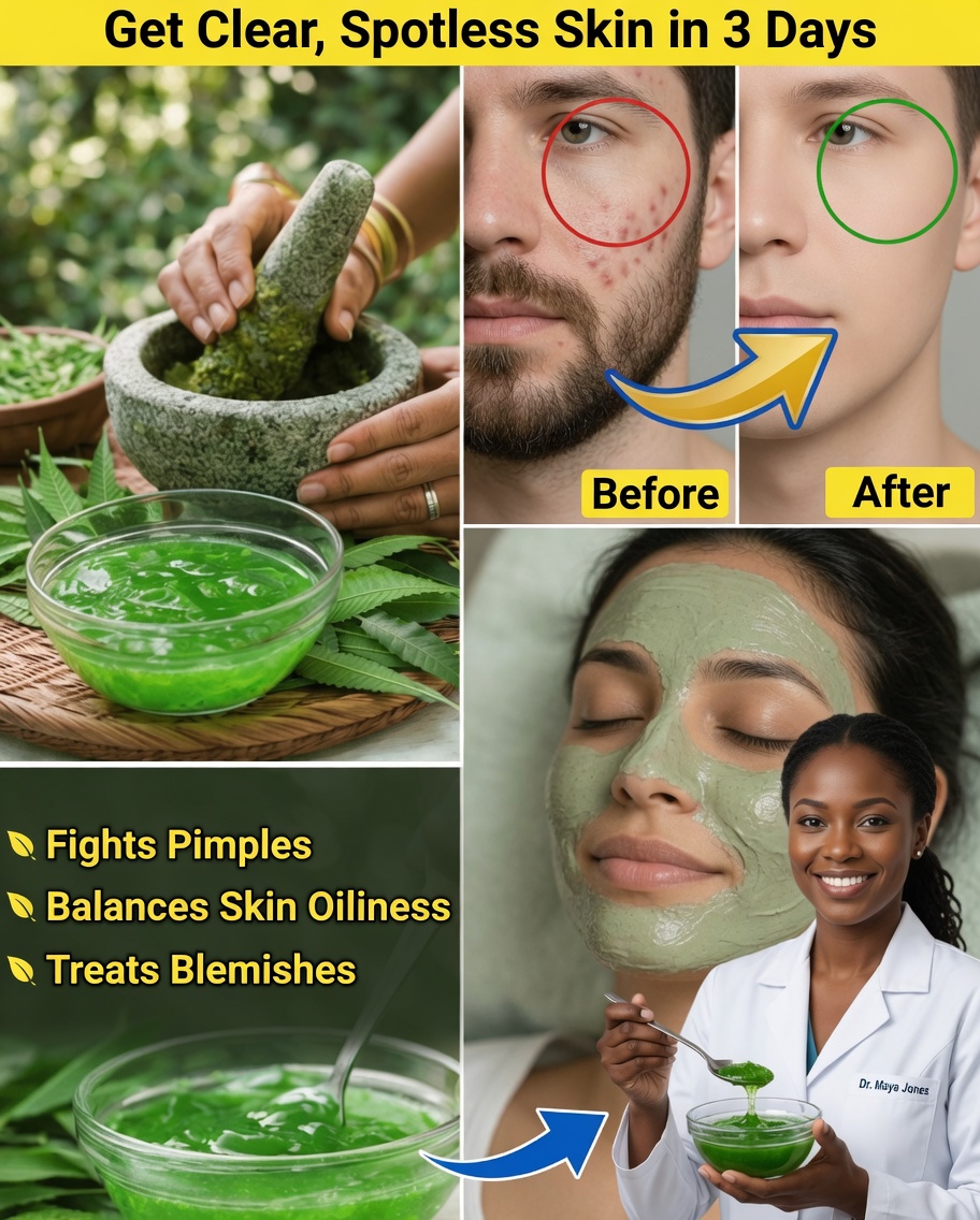 How to Make and Use Homemade Neem Gel for Healthier Skin at Home