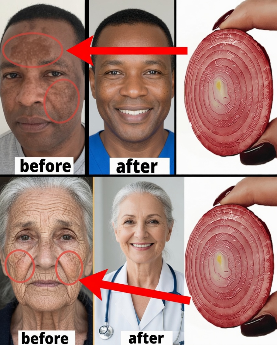 Mix Cornstarch with Onion for Snow-White, Glass-Clear Skin: A Natural Secret You'll Wish You Knew Sooner