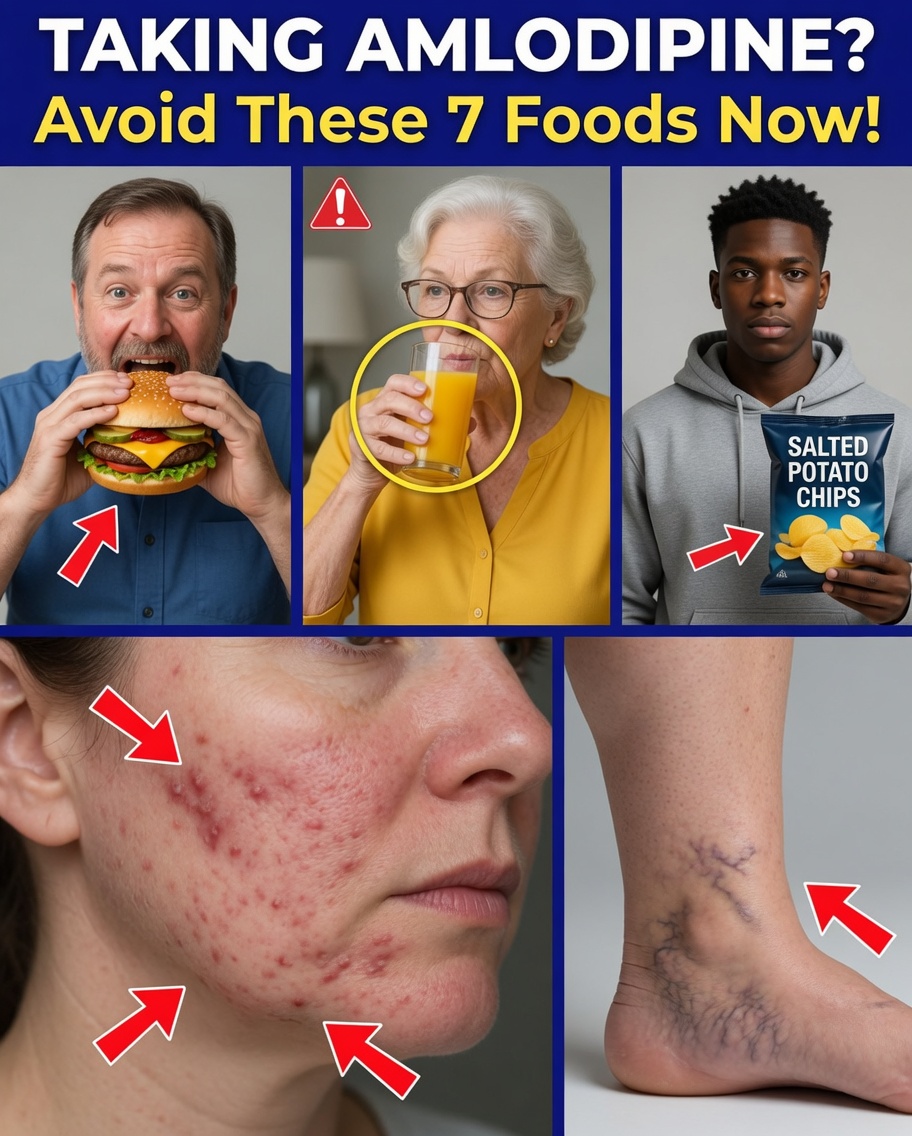 7 Foods That Can Silently Worsen Amlodipine Side Effects (And Smart Swaps to Feel Better Fast)