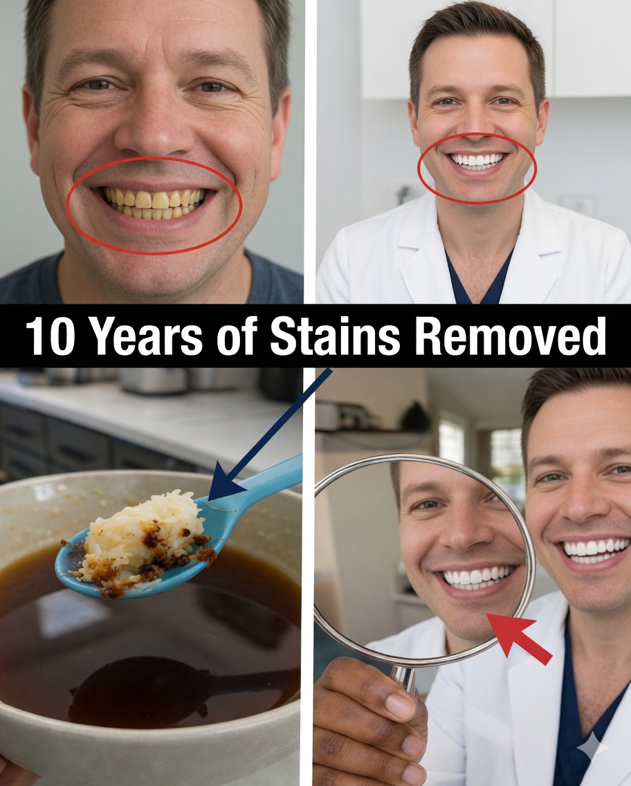 Remove 10 Years of Tooth Stains in 2 Minutes? The Truth That Will Surprise You