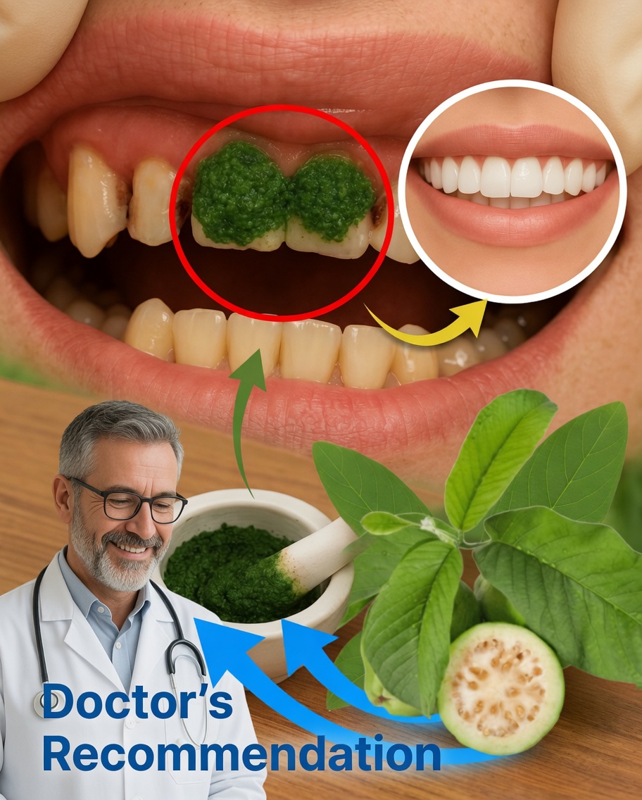 3 Powerful Ways Guava Leaves Fight Tooth Decay