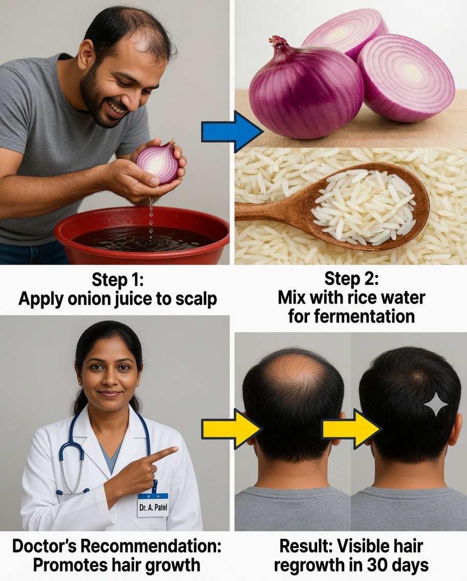 This Recipe Will Make Your Hair Grow Like Crazy: The Power of Onion and Rice to Lengthen and Thicken Your Hair