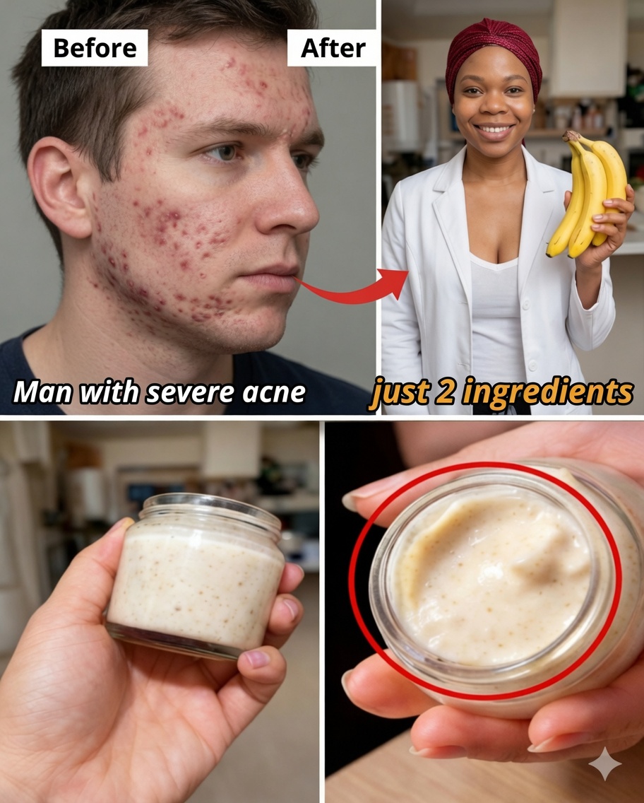 7 Natural Ways to Smooth Fine Lines and Brighten Skin Using Banana Peel