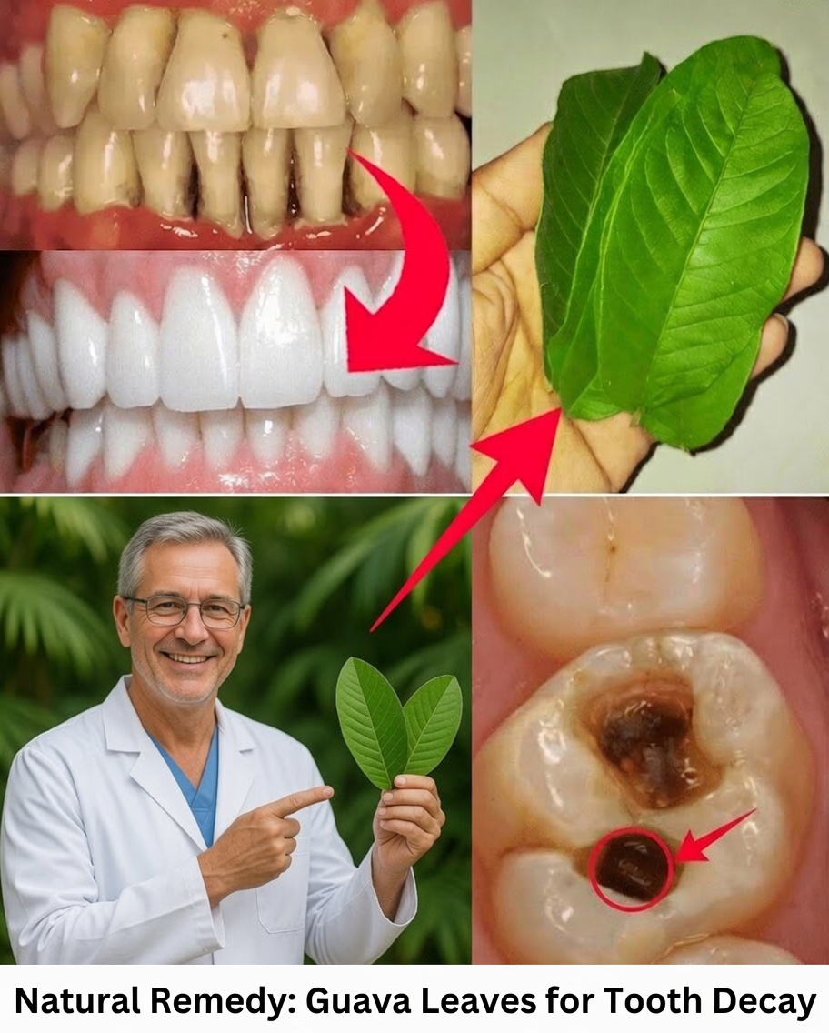 3 Simple and Affordable Ways to Treat Tooth Decay with Guava Leaves