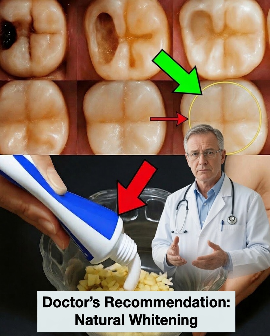 What Dentists Rarely Tell You: Natural Tips That Can Help Prevent Cavities