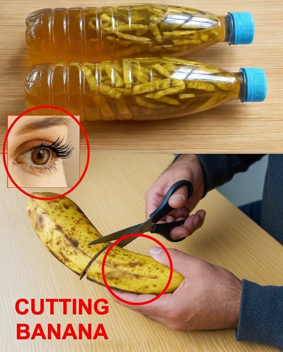Banana Peel: The Kitchen Waste with Surprising Benefits