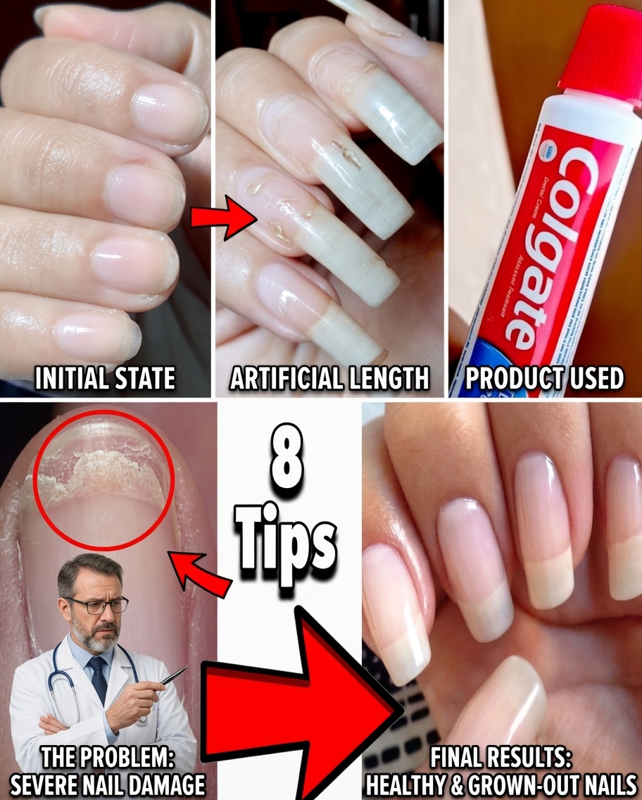 Revive Weak Nails Naturally: The Powerful Garlic Secret for Stronger, Healthier Nails