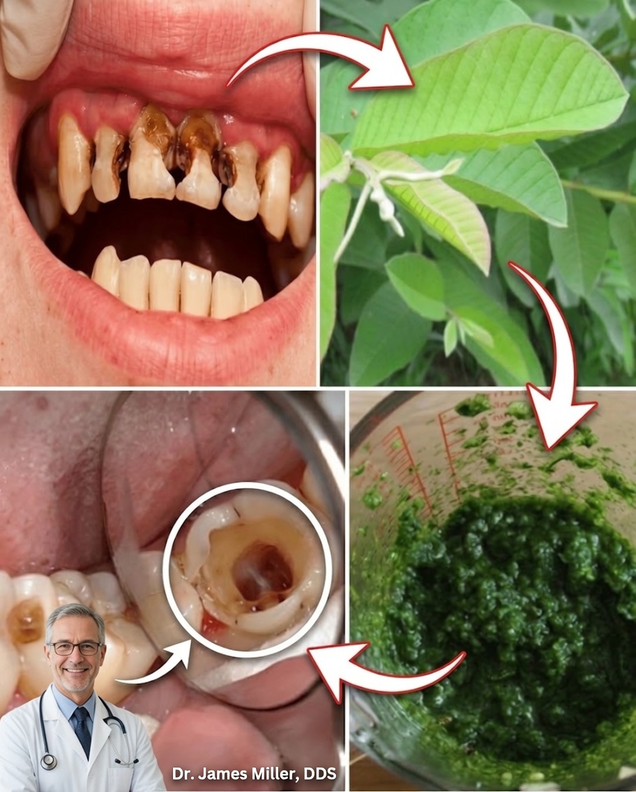 Guava Leaves for a Radiant Smile: The Natural Oral Care Secret Passed Down by a 70-Year-Old Grandma