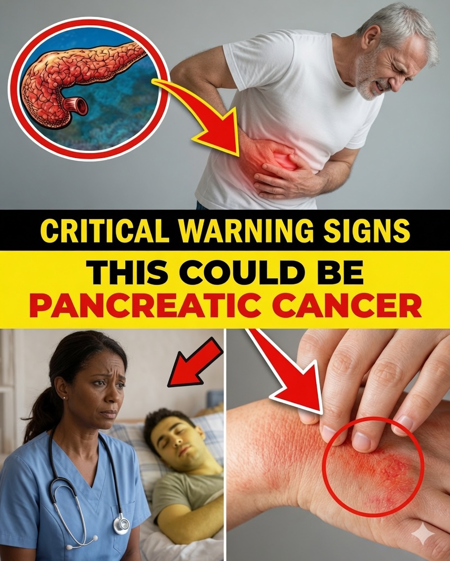10 Hidden Warning Signs of Pancreatic Cancer You’re Probably Ignoring
