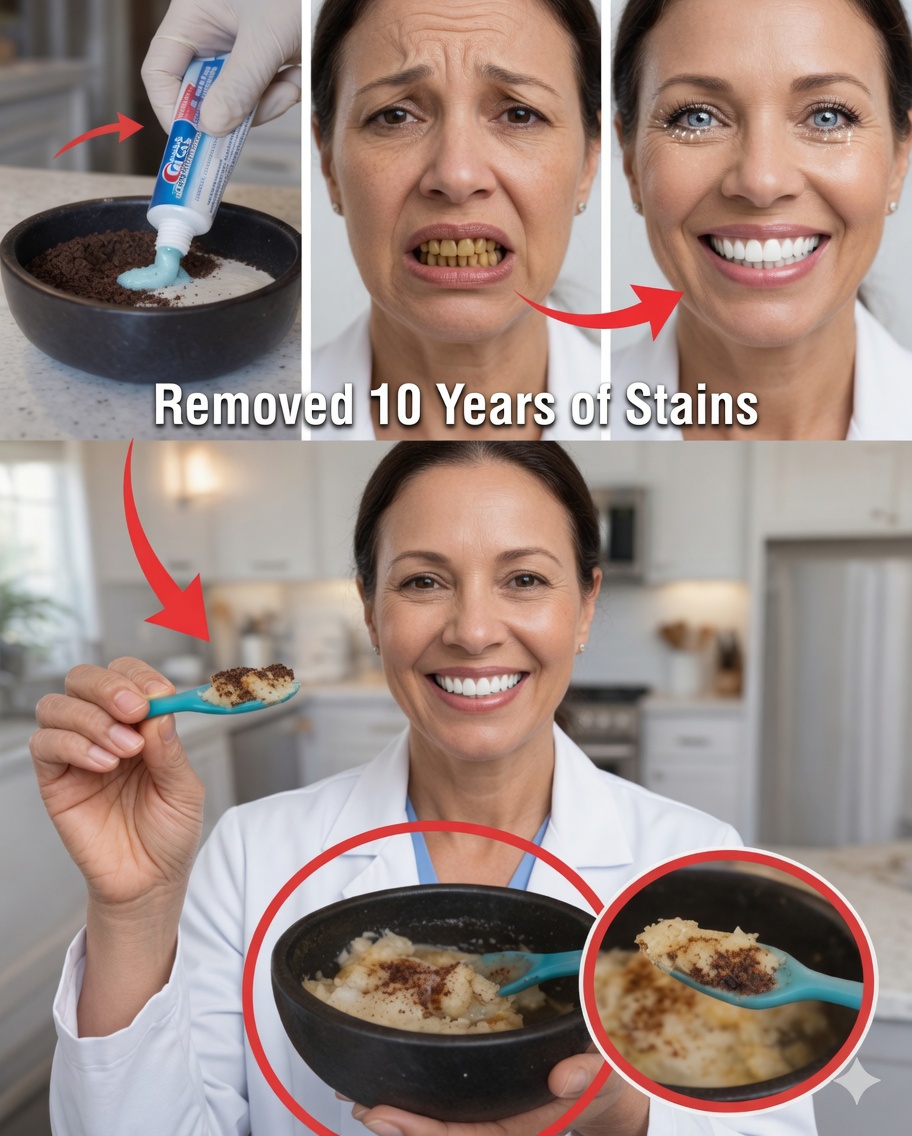 Remove Up to 10 Years of Tooth Stains in Just 2 Minutes – The Natural Whitener That’s Getting Attention