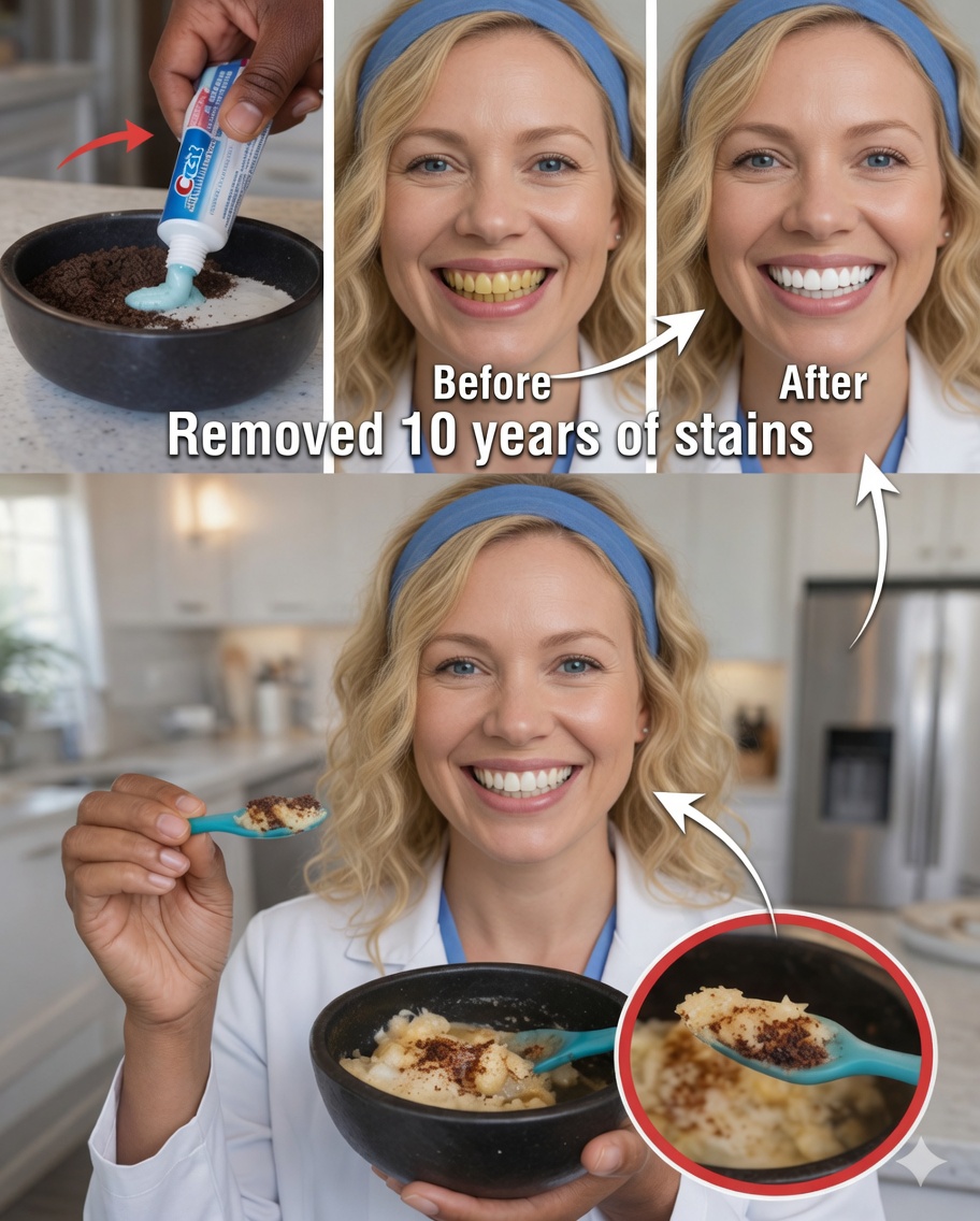Remove up to 10 years of tooth stains in just 2 minutes – The natural whitening product that’s getting attention